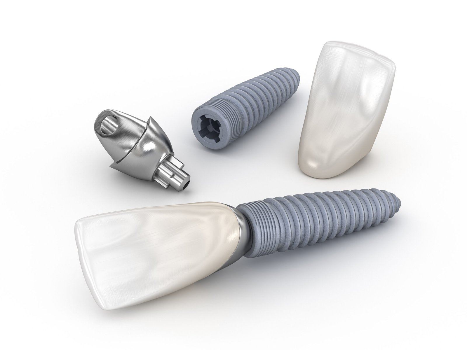 Zahnimplantate in der Oralchirurgie Leipzig