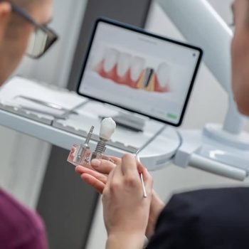 Zahnimplantate Leipzig